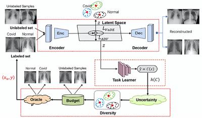 Variational deep embedding-based active learning for the diagnosis of pneumonia